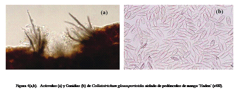Cuadro de texto:  



Figura 4(a,b).  Acrvulos (a) y Conidias (b) de Colletotrichum gloeosporioides aislado de pednculos de mango Haden (x400).

