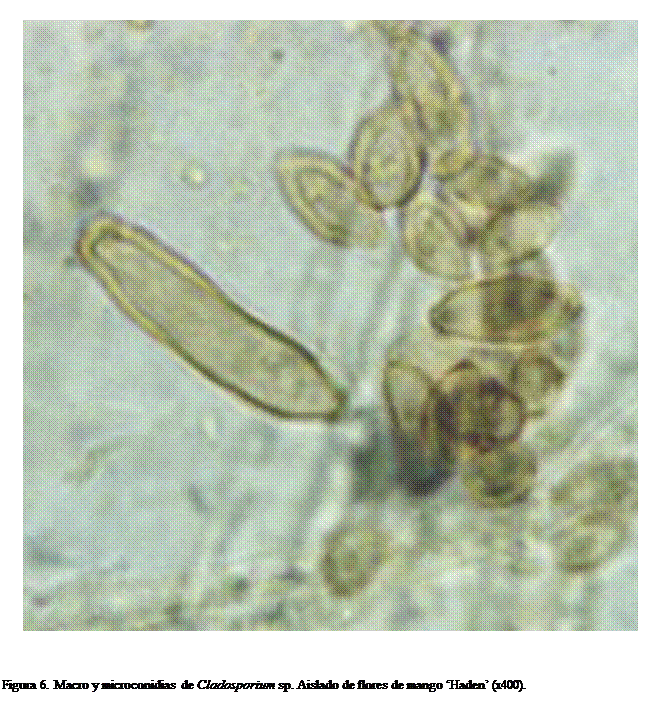 Cuadro de texto:  



Figura 6. Macro y microconidias de Cladosporium sp. Aislado de flores de mango Haden (x400). 


