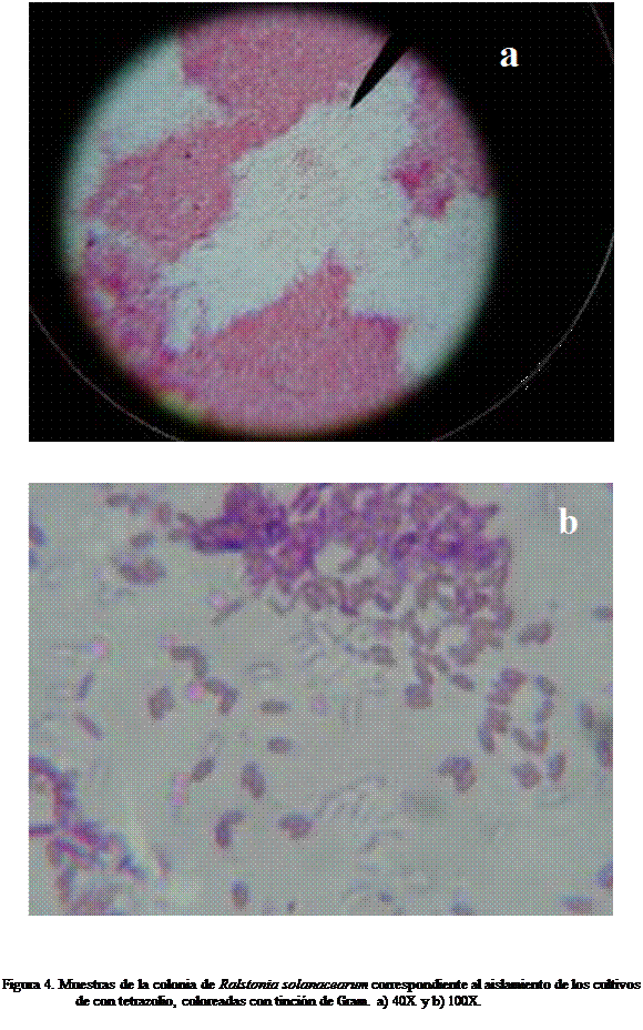 Cuadro de texto:  

 
                                                                                                                                                                  

Figura 4. Muestras de la colonia de Ralstonia solanacearum correspondiente al aislamiento de los cultivos de con tetrazolio, coloreadas con tincin de Gram. a) 40X y b) 100X.



